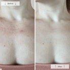 OmniluxOmnilux Contour Neck & DecolletéSkinShop