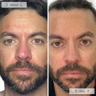 OmniluxOmnilux Men's LED Face MaskSkinShop