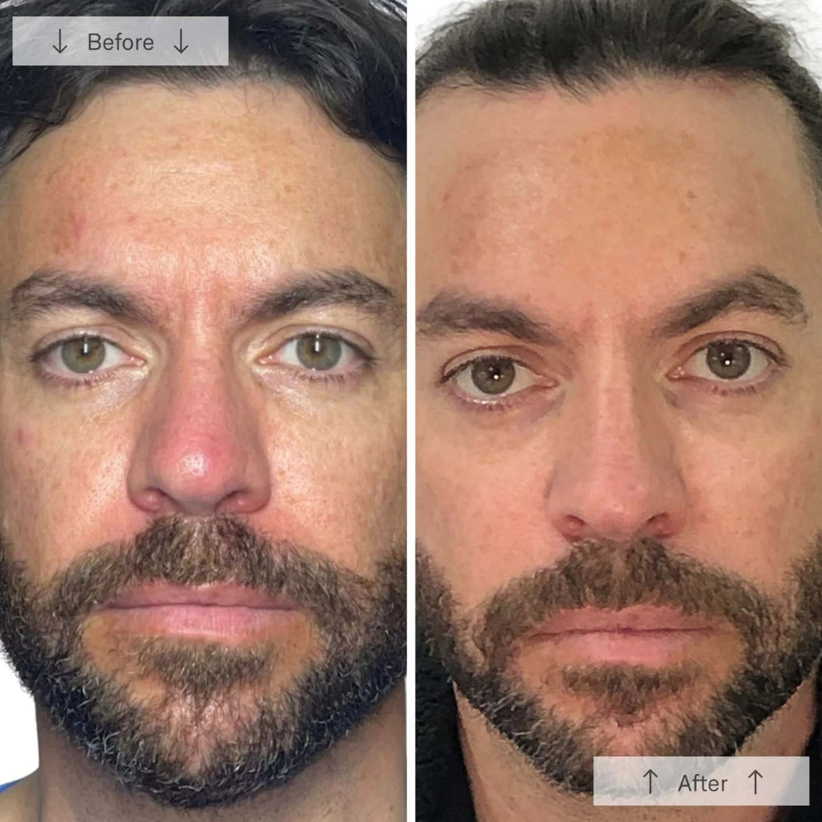 OmniluxOmnilux Men's LED Face MaskSkinShop