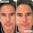 OmniluxOmnilux Men's LED Face MaskSkinShop