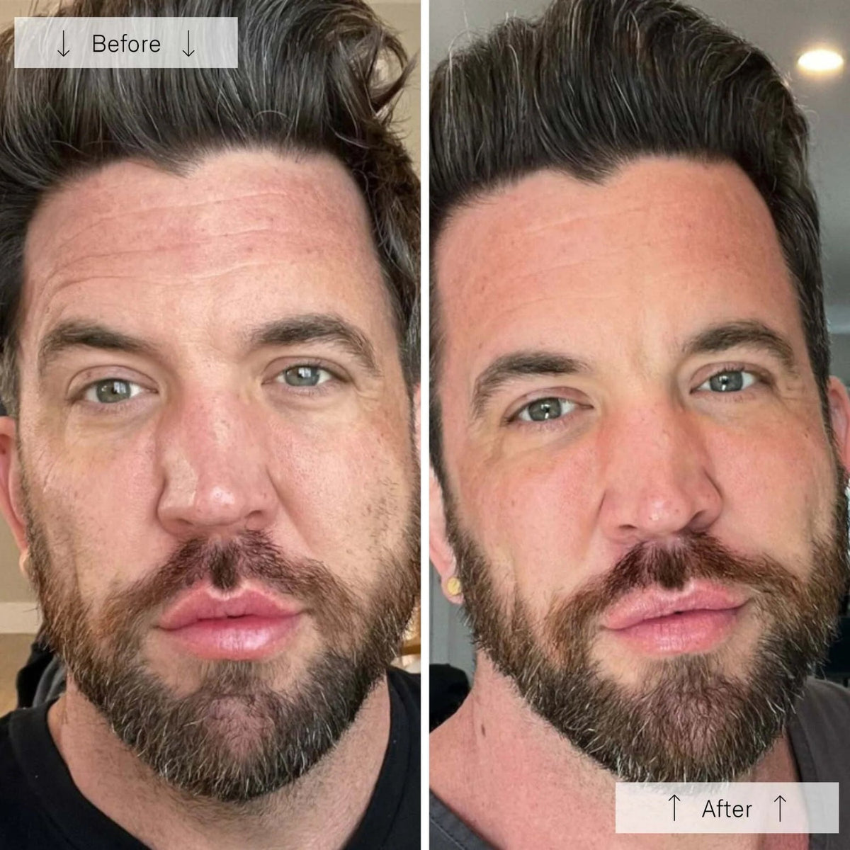 OmniluxOmnilux Men's LED Face MaskSkinShop