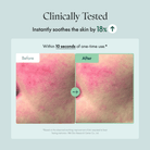PuritoPurito Wonder Releaf Centella Serum 60mlSkinShop