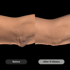 Revision SkincareRevision Skincare BodiContour 107gSkinShop