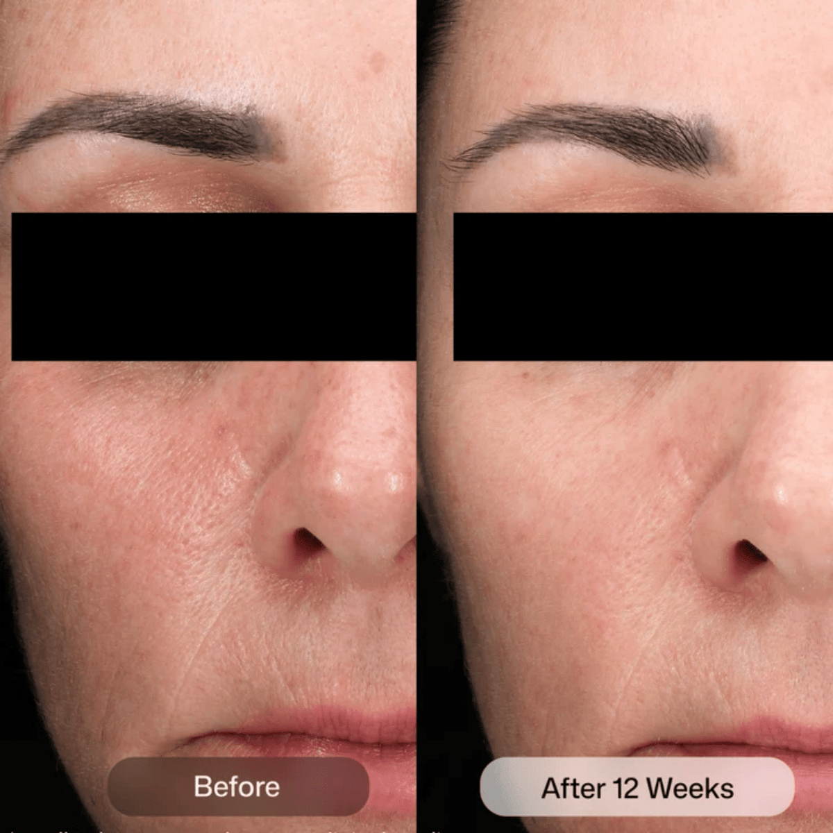 Revision SkincareRevision Skincare D.E.J Daily Boosting Serum 30mlSkinShop