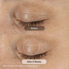 Revision SkincareRevision Skincare D.E.J Eye Cream 14gSkinShop