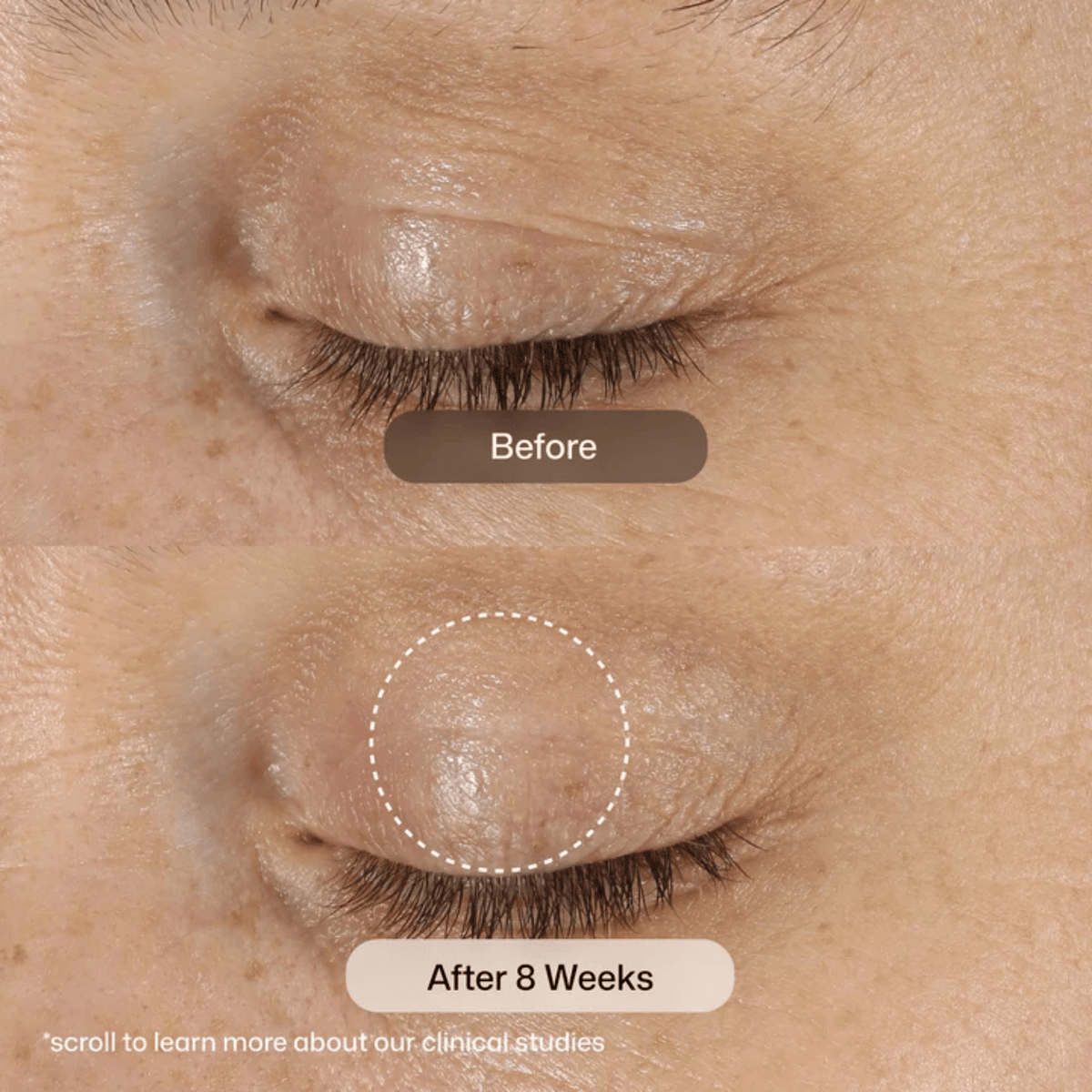 Revision SkincareRevision Skincare D.E.J Eye Cream 14gSkinShop