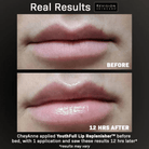 Revision SkincareRevision Skincare YouthFull Lip Replenisher 9.4gSkinShop