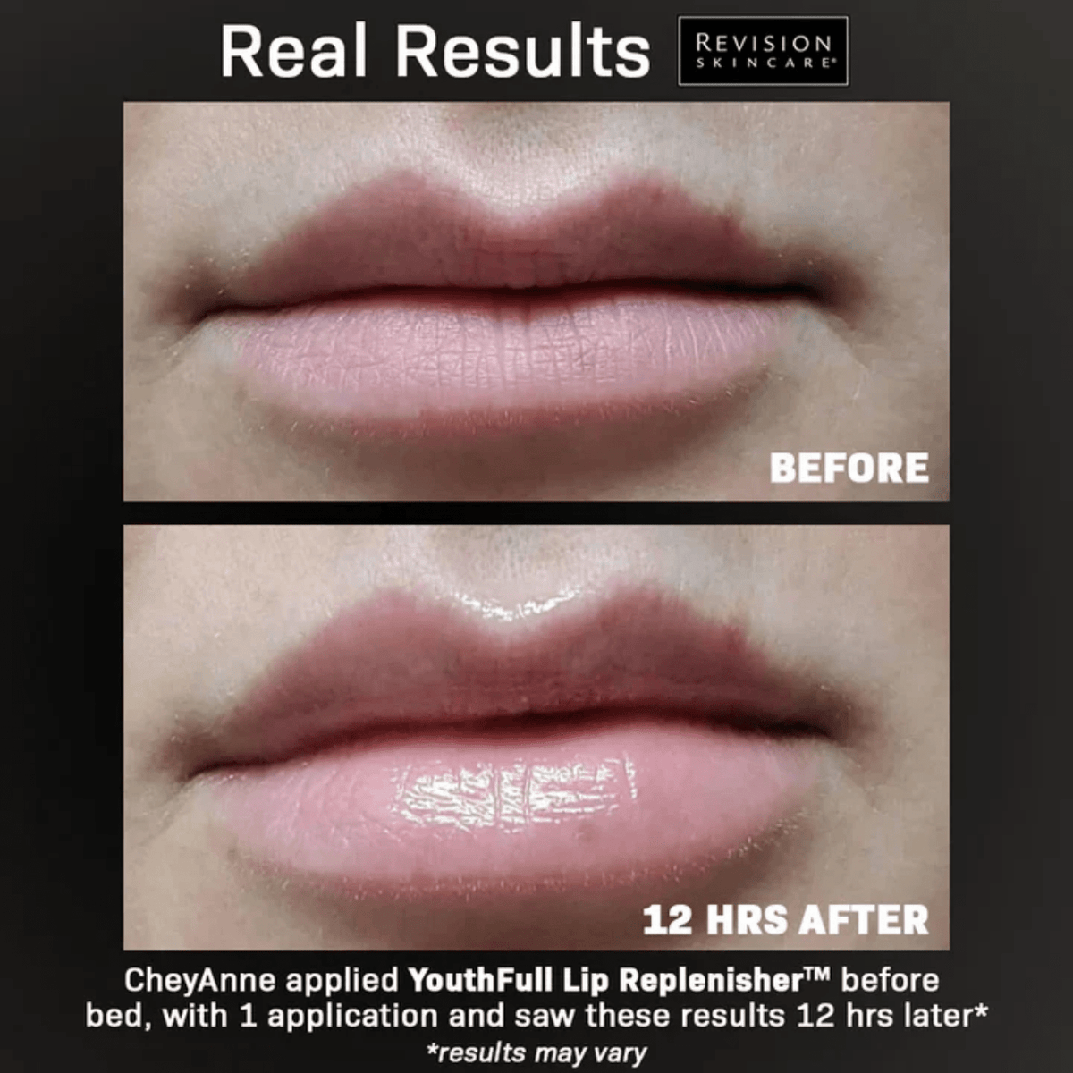 Revision SkincareRevision Skincare YouthFull Lip Replenisher 9.4gSkinShop