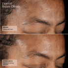 SentéSenté Dermal Repair Cream 50mlSkinShop
