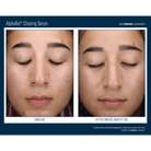 Skinbetter ScienceSkinbetter Science AlphaRet Clearing Serum 30mlSkinShop