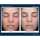 Skinbetter ScienceSkinbetter Science AlphaRet Clearing Serum 30mlSkinShop