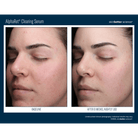Skinbetter ScienceSkinbetter Science AlphaRet Clearing Serum 30mlSkinShop