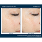 Skinbetter ScienceSkinbetter Science AlphaRet Exfoliating Peel Pads 30 PadsSkinShop