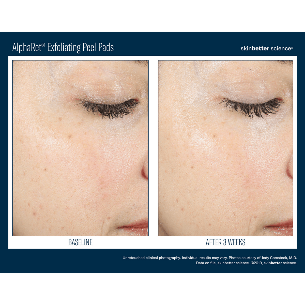 Skinbetter ScienceSkinbetter Science AlphaRet Exfoliating Peel Pads 30 PadsSkinShop