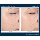 Skinbetter ScienceSkinbetter Science AlphaRet Exfoliating Peel Pads 30 PadsSkinShop