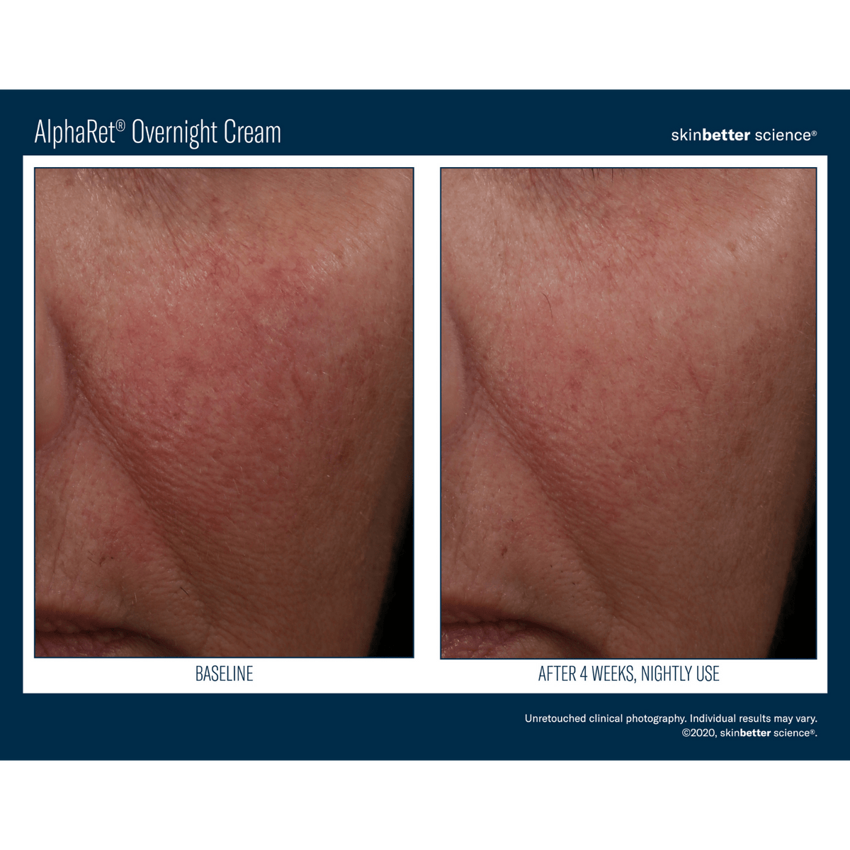 Skinbetter ScienceSkinbetter Science AlphaRet Overnight Cream 30mlSkinShop