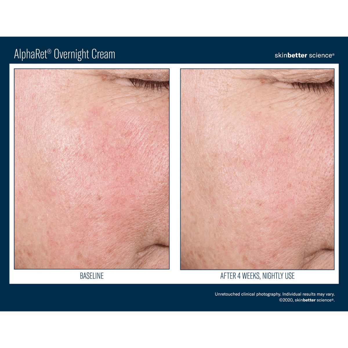 Skinbetter ScienceSkinbetter Science AlphaRet Overnight Cream 30mlSkinShop