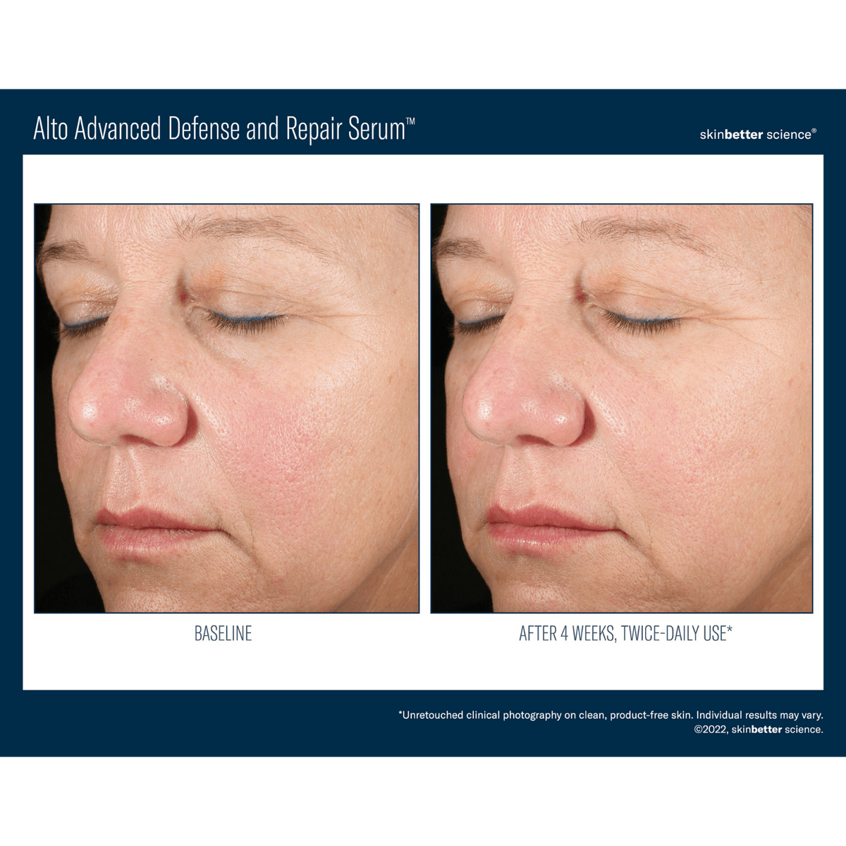 Skinbetter ScienceSkinbetter Science Alto Advanced Defense and Repair Serum 30mlSkinShop
