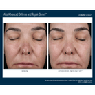Skinbetter ScienceSkinbetter Science Alto Advanced Defense and Repair Serum 30mlSkinShop