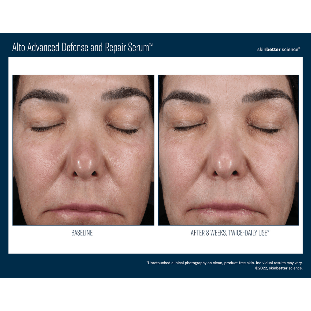Skinbetter ScienceSkinbetter Science Alto Advanced Defense and Repair Serum 30mlSkinShop