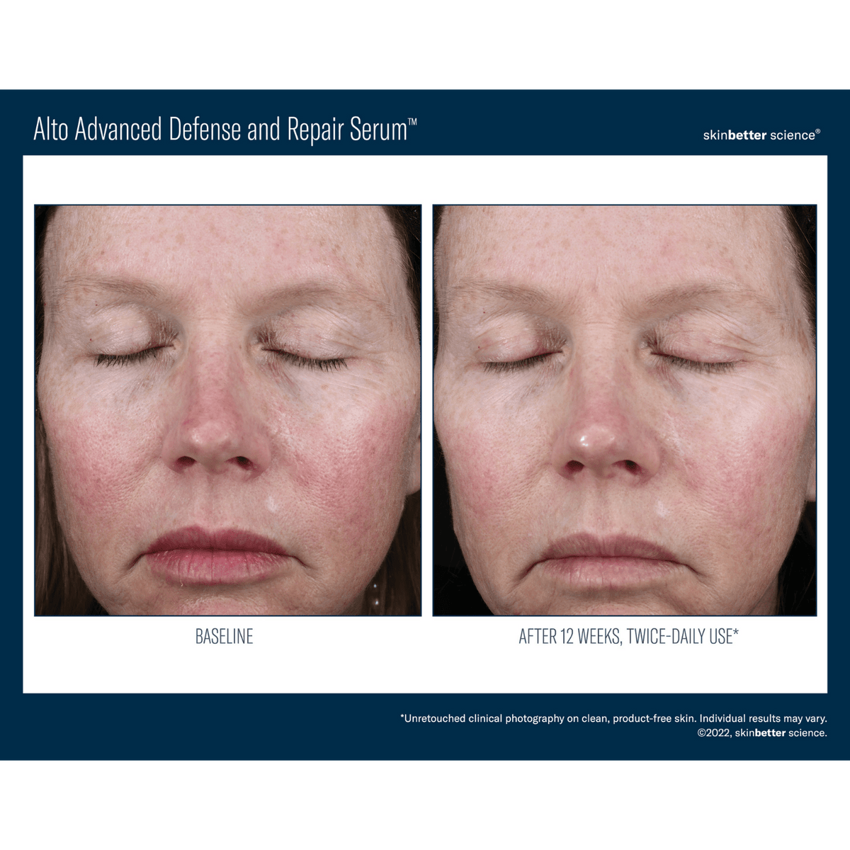 Skinbetter ScienceSkinbetter Science Alto Advanced Defense and Repair Serum 30mlSkinShop