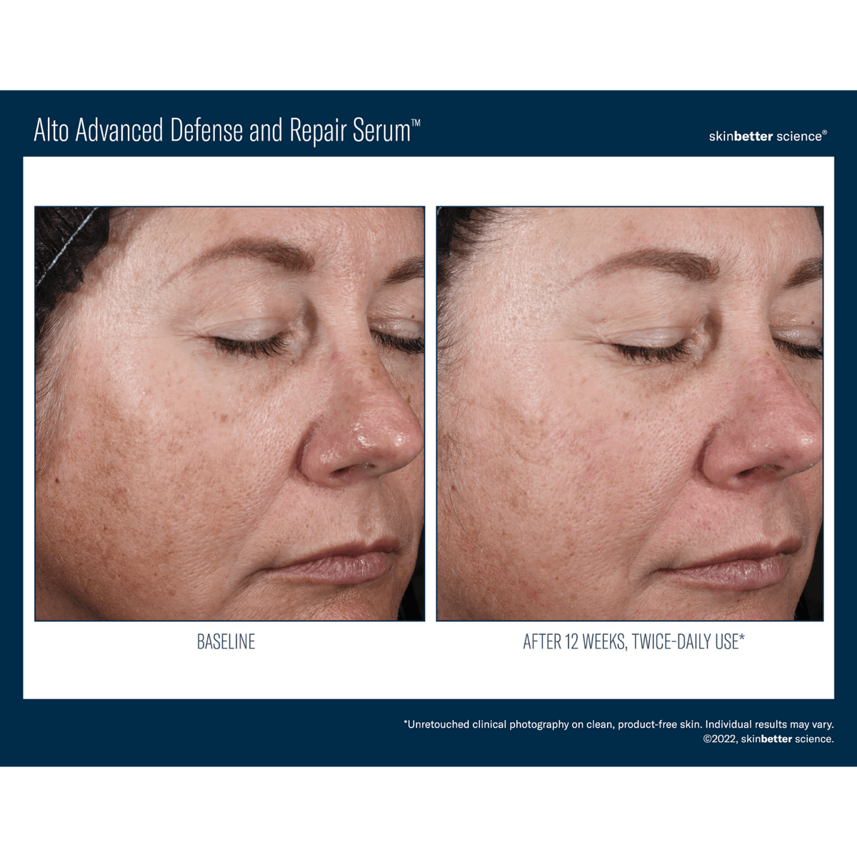 Skinbetter ScienceSkinbetter Science Alto Advanced Defense and Repair Serum 30mlSkinShop