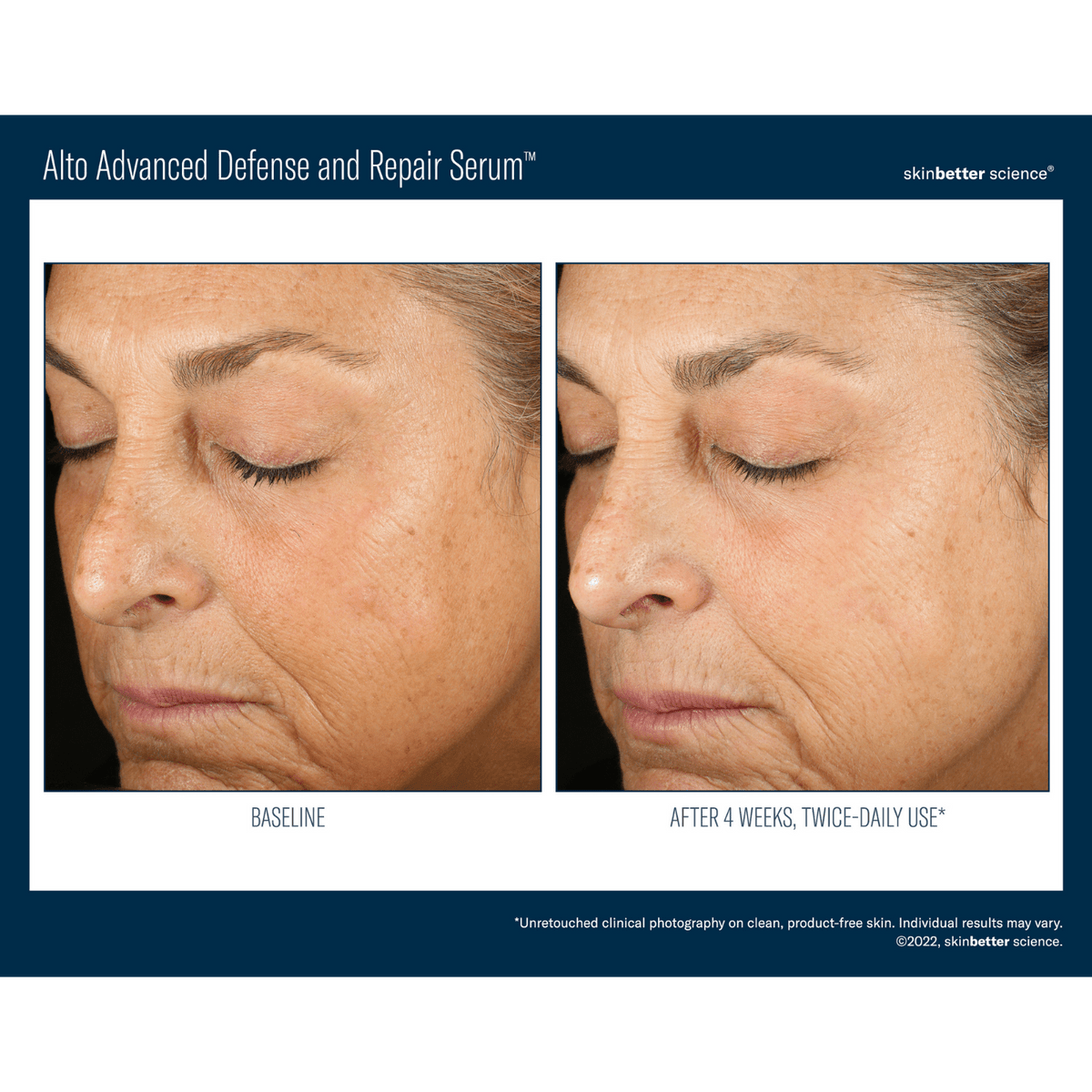Skinbetter ScienceSkinbetter Science Alto Advanced Defense and Repair Serum 30mlSkinShop