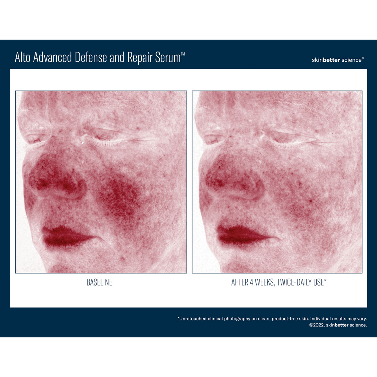Skinbetter ScienceSkinbetter Science Alto Advanced Defense and Repair Serum 30mlSkinShop