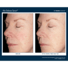 Skinbetter ScienceSkinbetter Science Alto Defense Serum 30mlSkinShop