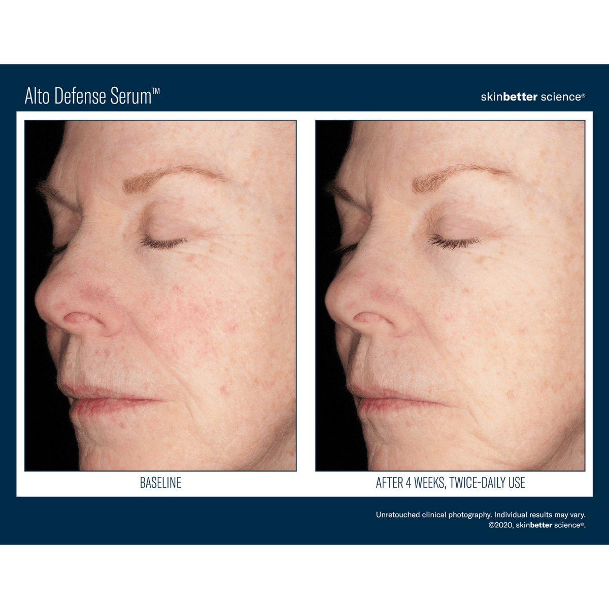 Skinbetter ScienceSkinbetter Science Alto Defense Serum 30mlSkinShop