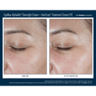 Skinbetter ScienceSkinbetter Science EyeMax AlphaRet Overnight Cream 15mlSkinShop