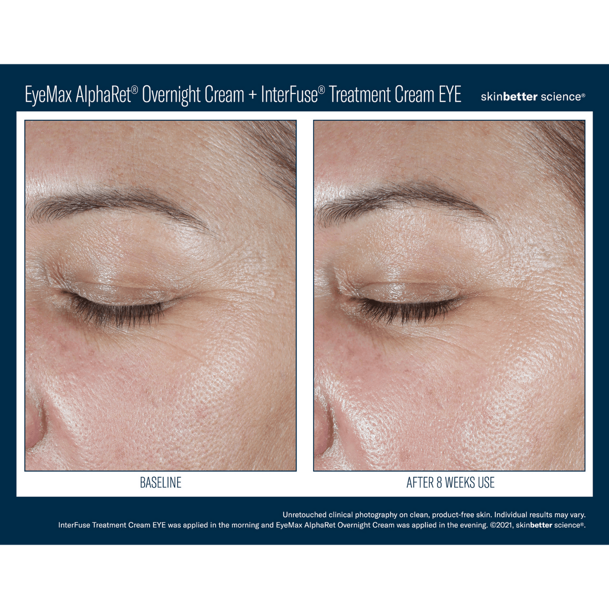 Skinbetter ScienceSkinbetter Science EyeMax AlphaRet Overnight Cream 15mlSkinShop