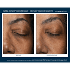 Skinbetter ScienceSkinbetter Science EyeMax AlphaRet Overnight Cream 15mlSkinShop