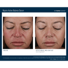 Skinbetter ScienceSkinbetter Science Mystro Active Balance Serum 15mlSkinShop