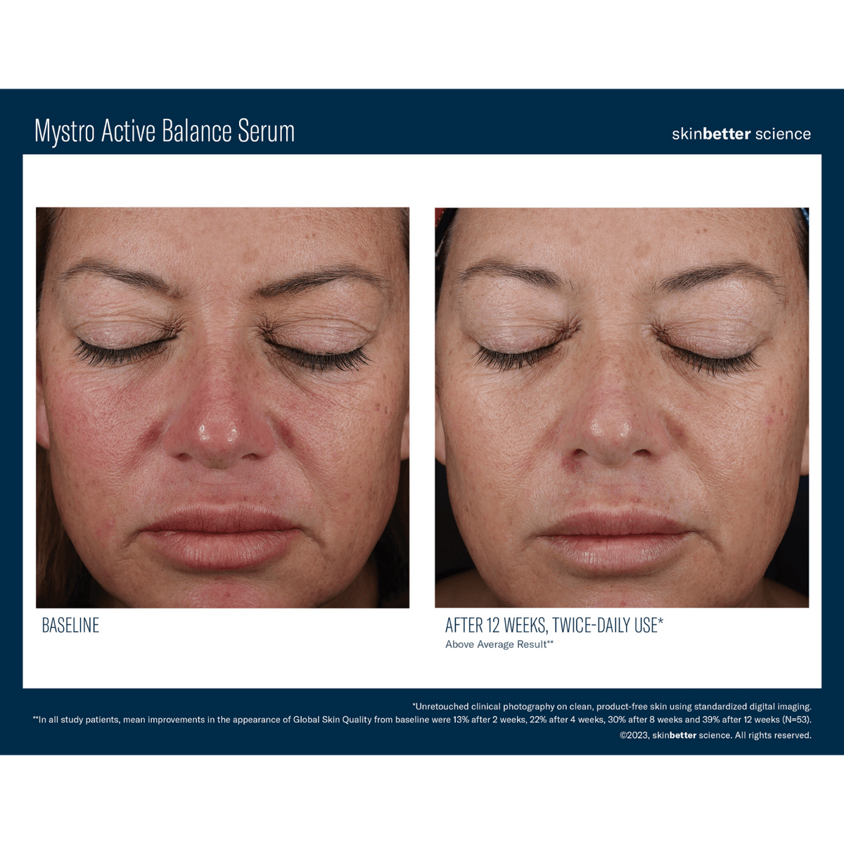 Skinbetter ScienceSkinbetter Science Mystro Active Balance Serum 15mlSkinShop