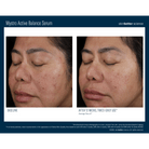 Skinbetter ScienceSkinbetter Science Mystro Active Balance Serum 15mlSkinShop