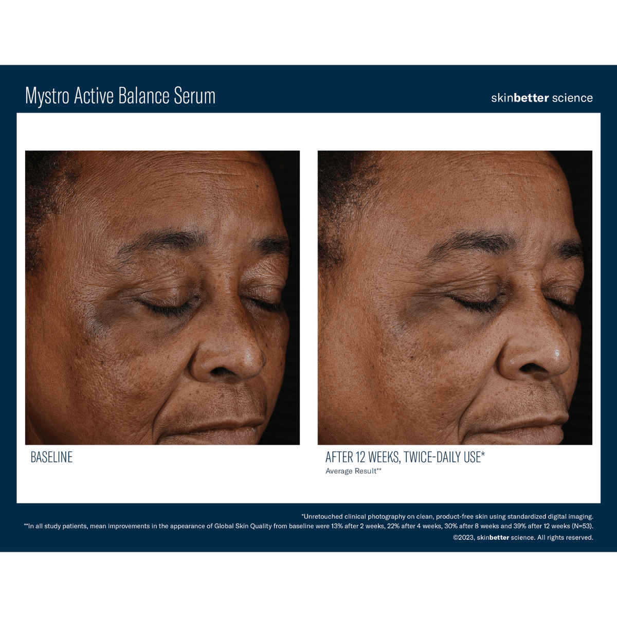 Skinbetter ScienceSkinbetter Science Mystro Active Balance Serum 15mlSkinShop
