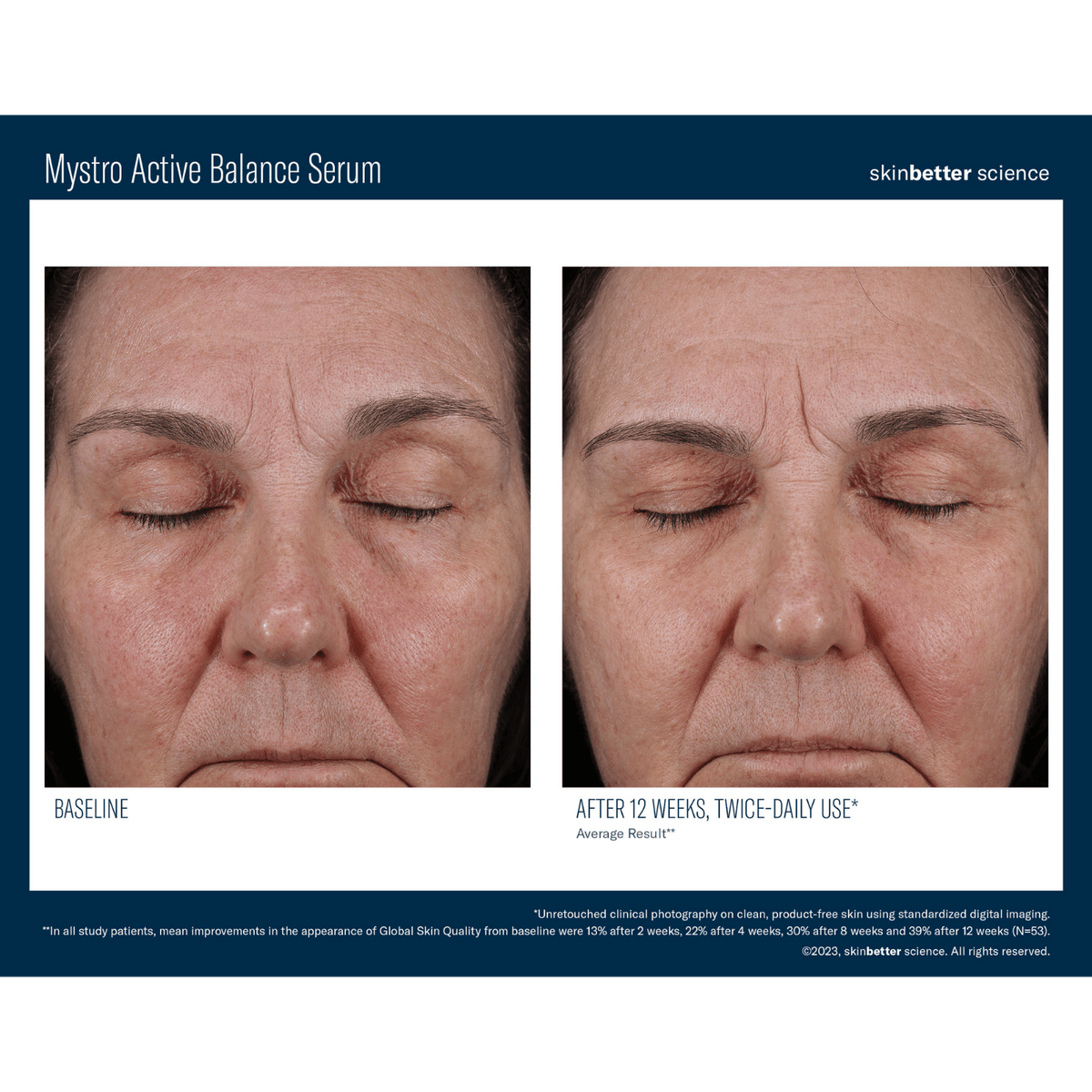 Skinbetter ScienceSkinbetter Science Mystro Active Balance Serum 15mlSkinShop