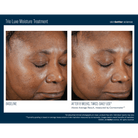Skinbetter ScienceSkinbetter Science Trio Luxe Moisture Treatment 50mlSkinShop
