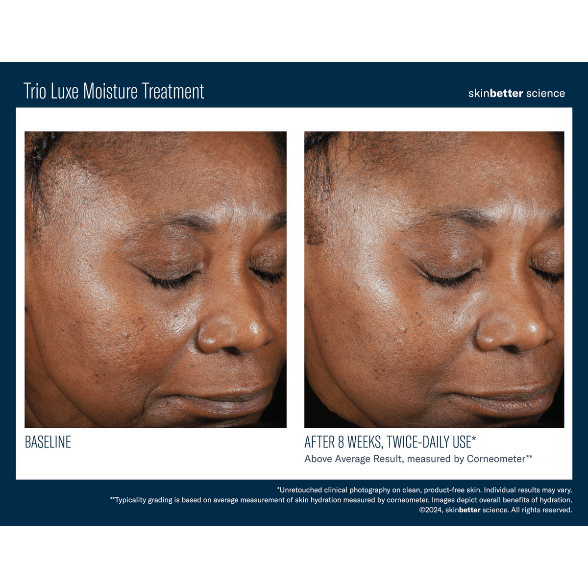Skinbetter ScienceSkinbetter Science Trio Luxe Moisture Treatment 50mlSkinShop