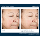 Skinbetter ScienceSkinbetter Science Trio Luxe Moisture Treatment 50mlSkinShop