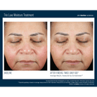 Skinbetter ScienceSkinbetter Science Trio Luxe Moisture Treatment 50mlSkinShop