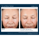 Skinbetter ScienceSkinbetter Science Trio Luxe Moisture Treatment 50mlSkinShop