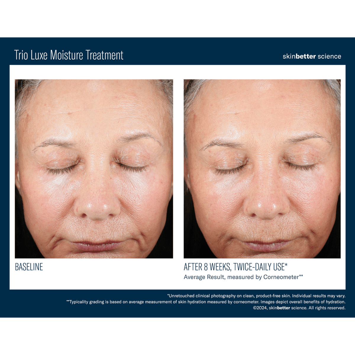 Skinbetter ScienceSkinbetter Science Trio Luxe Moisture Treatment 50mlSkinShop