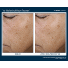 Skinbetter ScienceSkinbetter Science Trio Rebalancing Moisture Treatment 50mlSkinShop