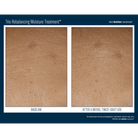 Skinbetter ScienceSkinbetter Science Trio Rebalancing Moisture Treatment 50mlSkinShop