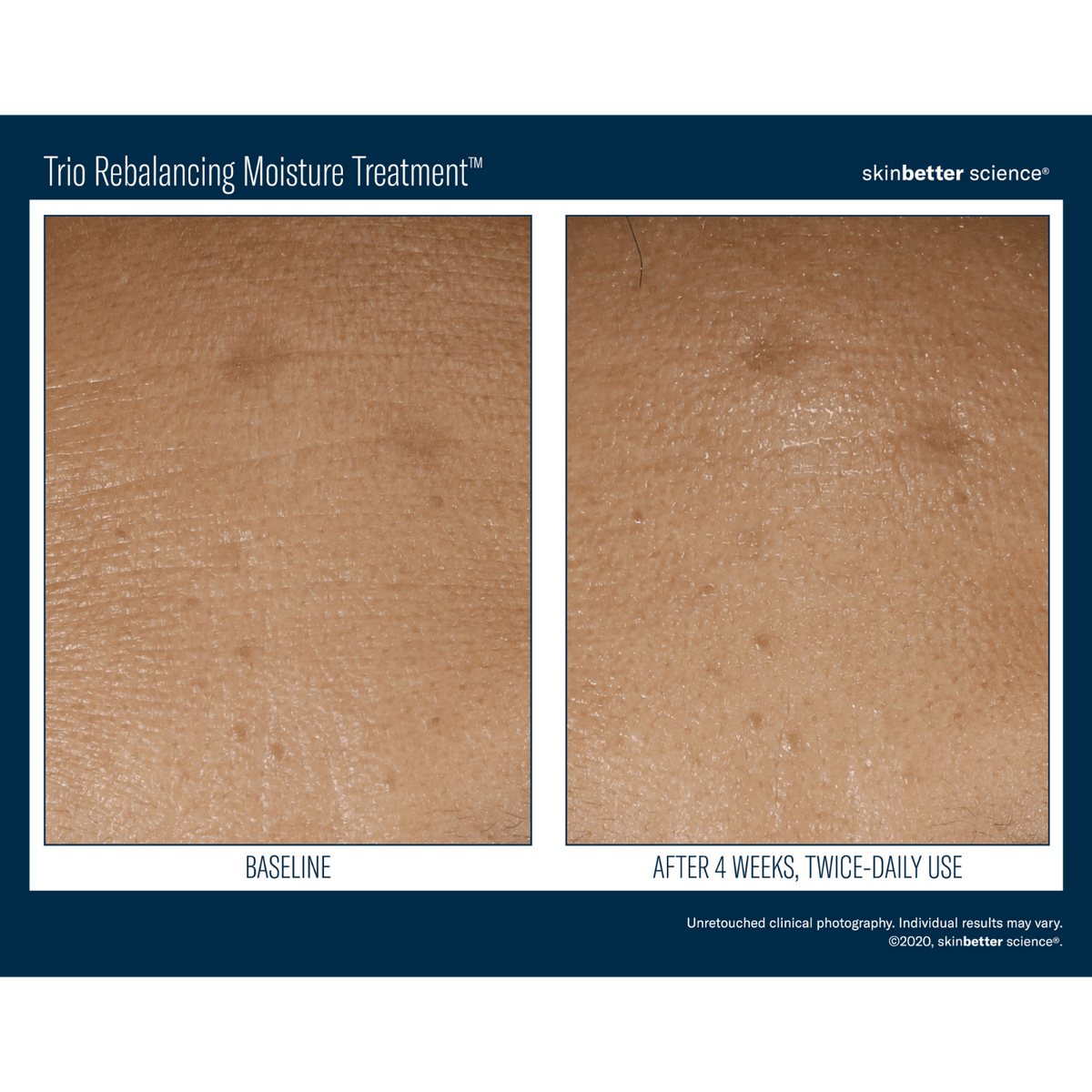 Skinbetter ScienceSkinbetter Science Trio Rebalancing Moisture Treatment 50mlSkinShop