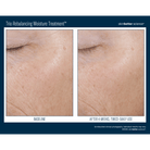 Skinbetter ScienceSkinbetter Science Trio Rebalancing Moisture Treatment 50mlSkinShop