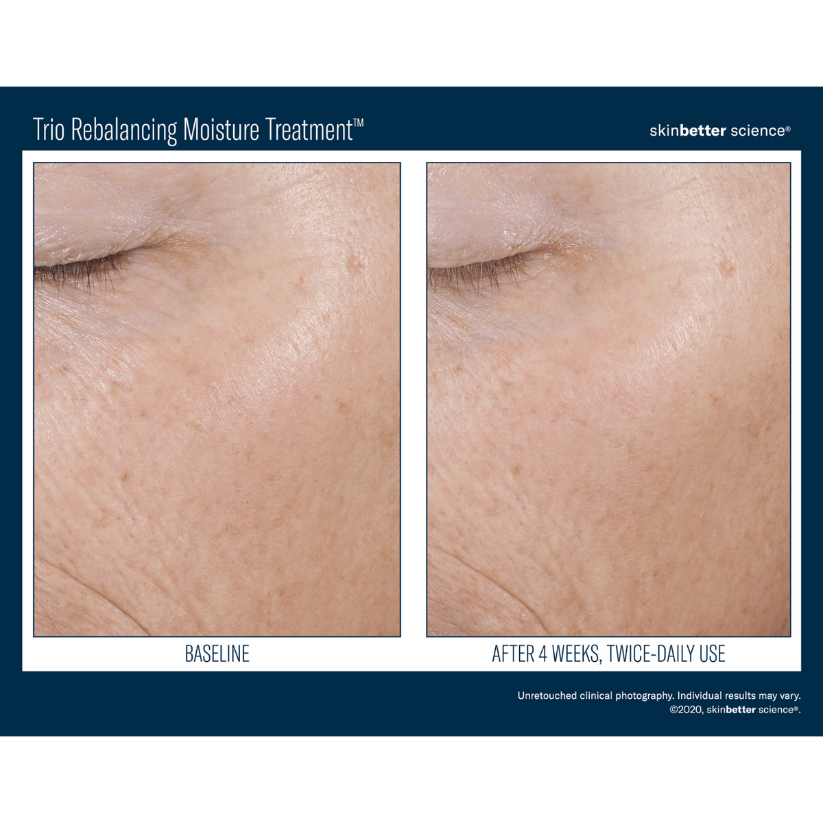 Skinbetter ScienceSkinbetter Science Trio Rebalancing Moisture Treatment 50mlSkinShop