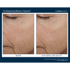 Skinbetter ScienceSkinbetter Science Trio Rebalancing Moisture Treatment 50mlSkinShop